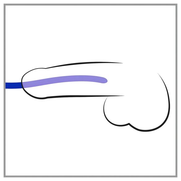 You2Toys - dilatador peniano - conjunto 3 peças silicone