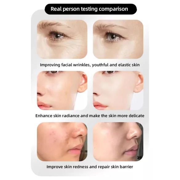 Máscara Facial LED Rejuvenescedora Foton (4 Modos de Fototerapia)